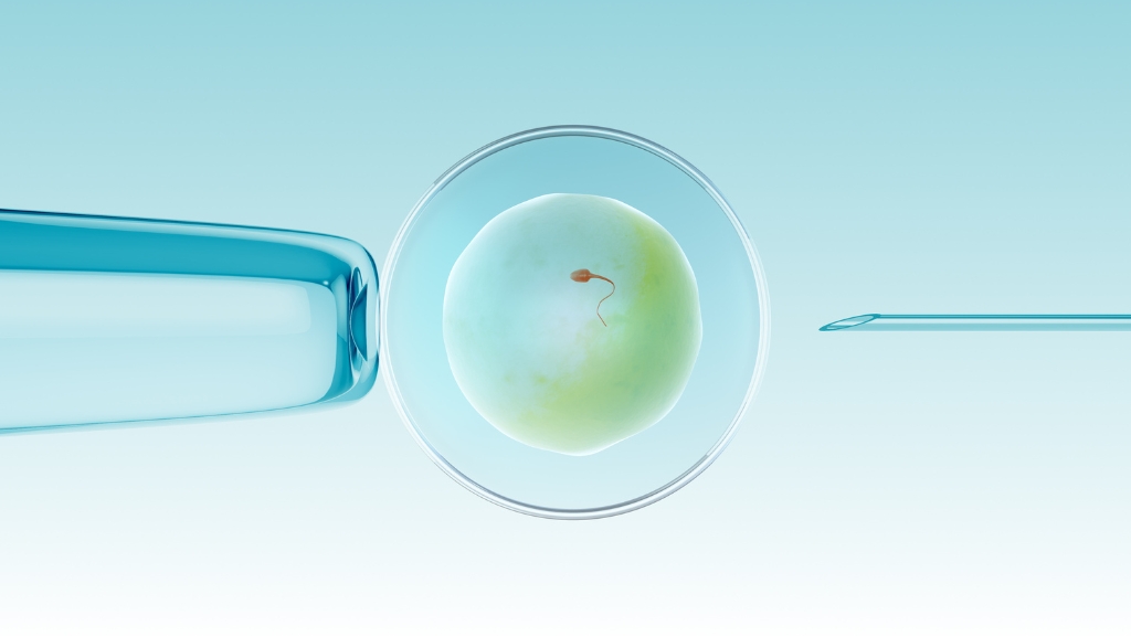 IUI hoặc IVF là những kỹ thuật hỗ trợ sinh sản hiện đại và hiệu quả