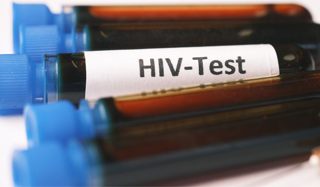 Xét nghiệm máu có phát hiện HIV không? Nên xét nghiệm vào thời điểm nào? 1