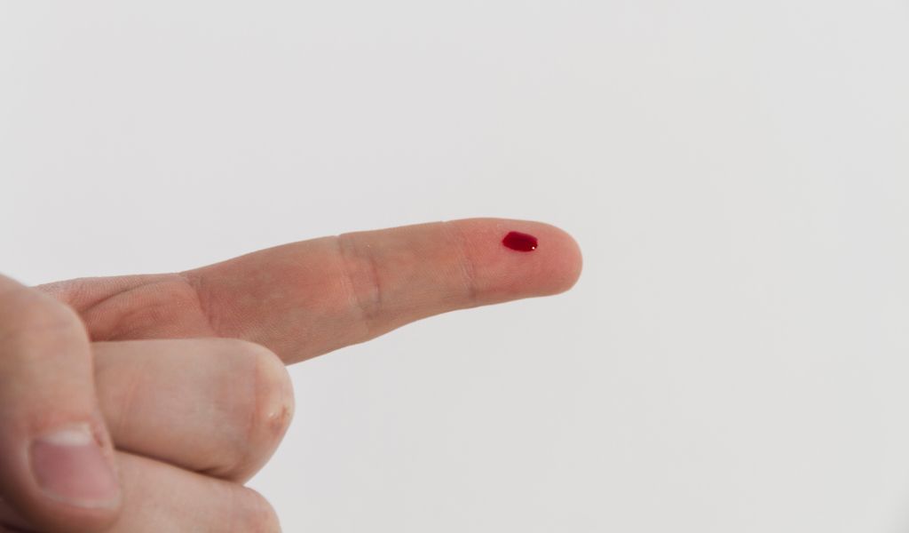 Xét nghiệm máu có phát hiện HIV không? Nên xét nghiệm vào thời điểm nào? 3