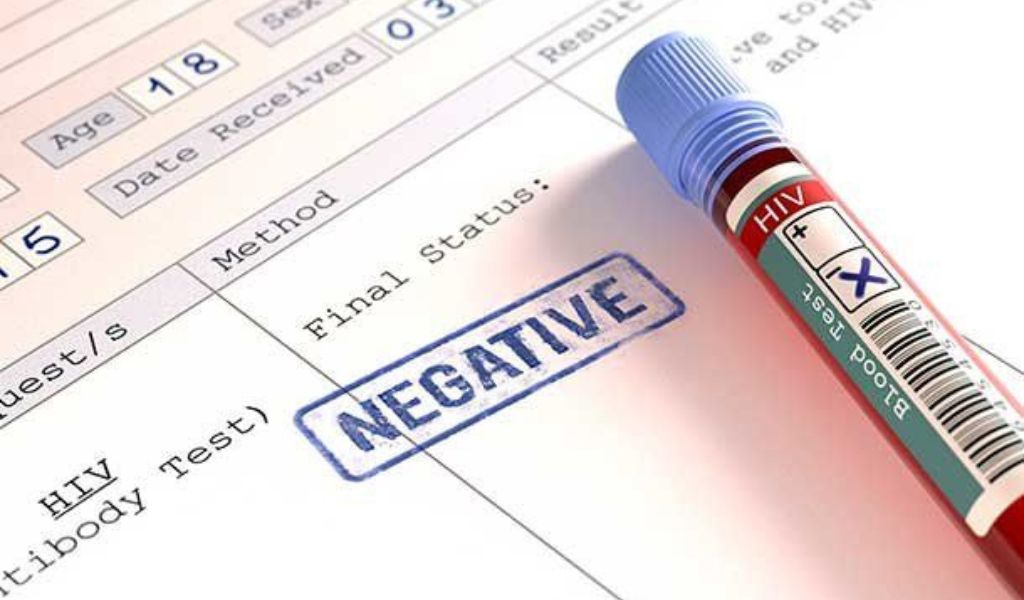 Cách đọc kết quả xét nghiệm HIV dễ dàng và chính xác 1