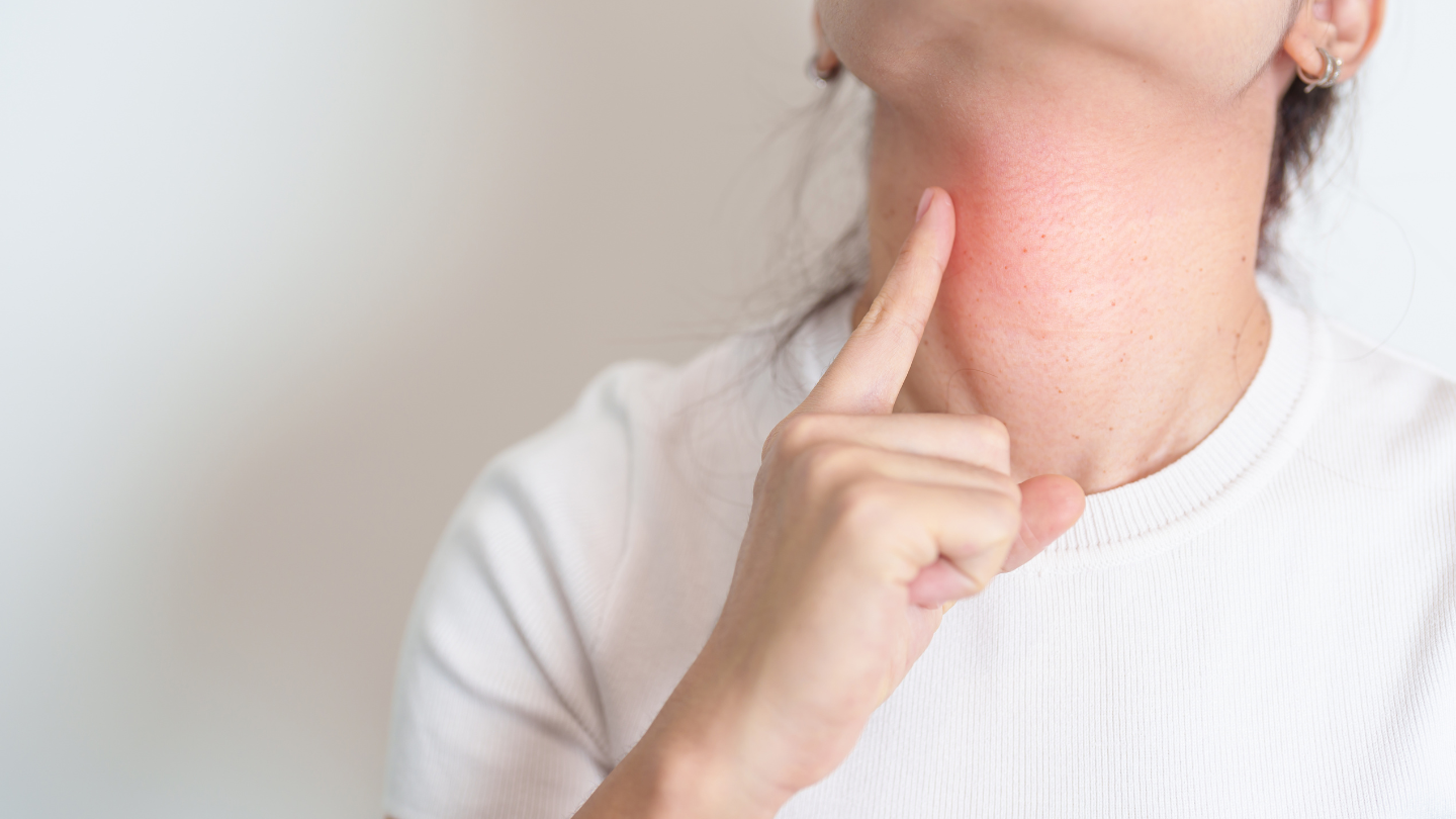 Nang giáp móng là một dị tật bẩm sinh vùng cổ