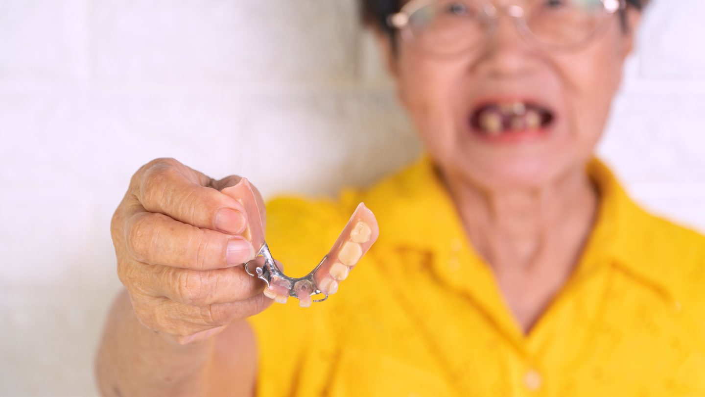 Người bị rụng nhiều răng nên nhai kém, làm tăng nguy cơ tắc ruột do bã thức ăn
