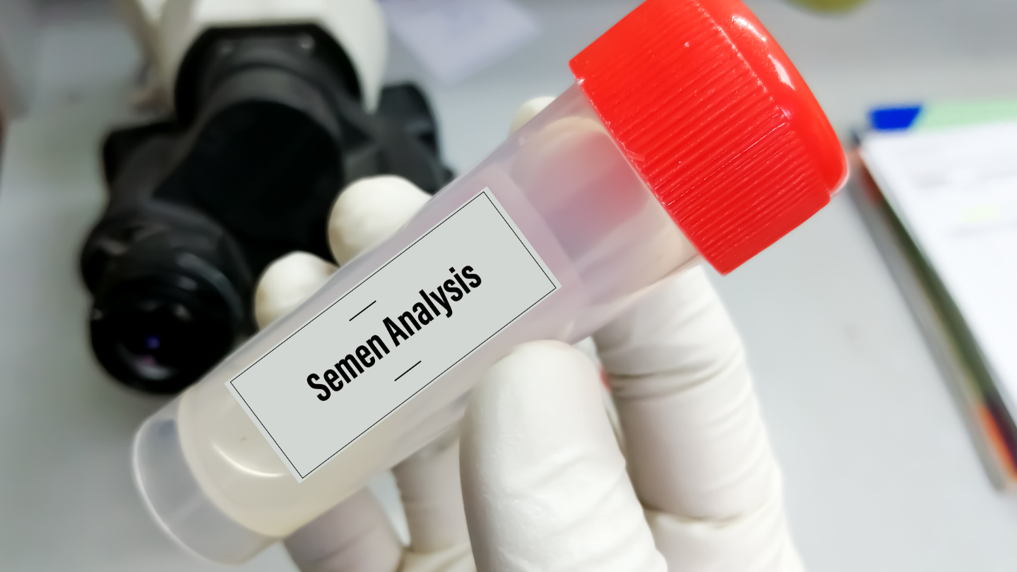 Xét nghiệm tinh dịch đồ ở đâu là câu hỏi đặt ra của nhiều người