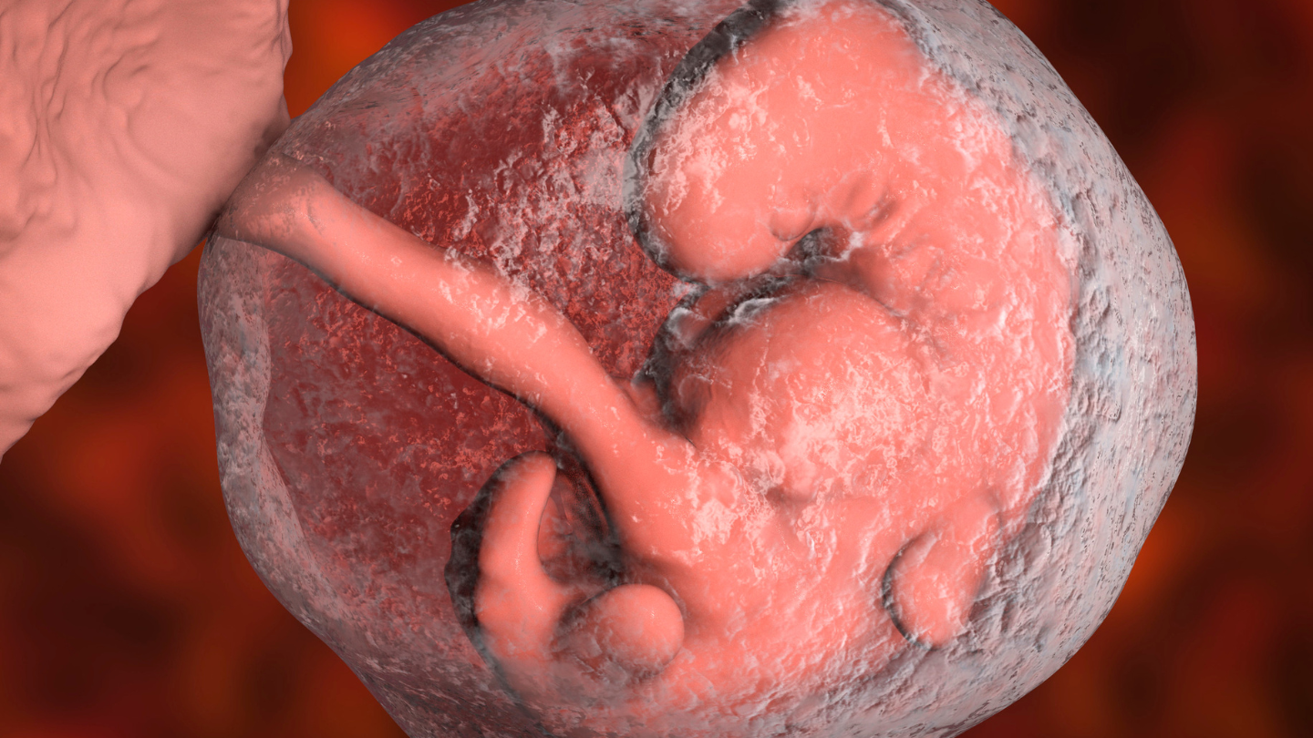 Túi ối nhỏ hơn tuổi thai trong 3 tháng đầu có nguy hiểm không là thắc mắc của nhiều người