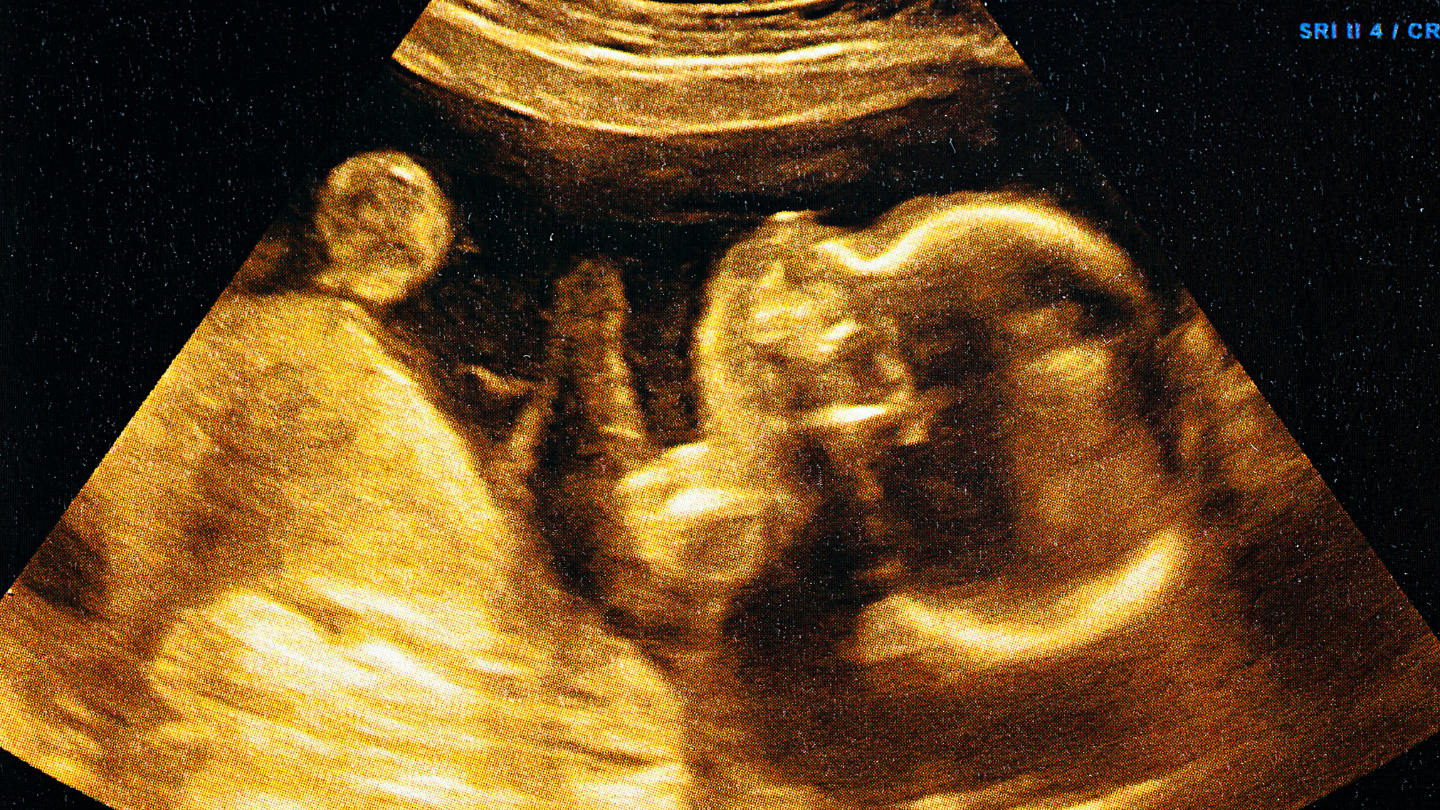 Thai 37 tuần là thời điểm em bé đã phát triển gần như hoàn chỉnh và bắt đầu được xem là thai đủ tháng sớm