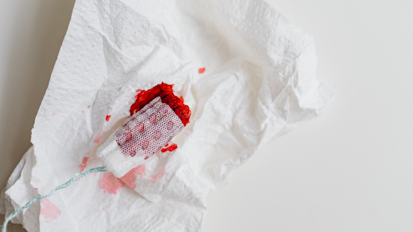 Mang thai 6 tuần ra máu như kinh nguyệt có nguy hiểm không là nỗi lo lắng của nhiều mẹ bầu