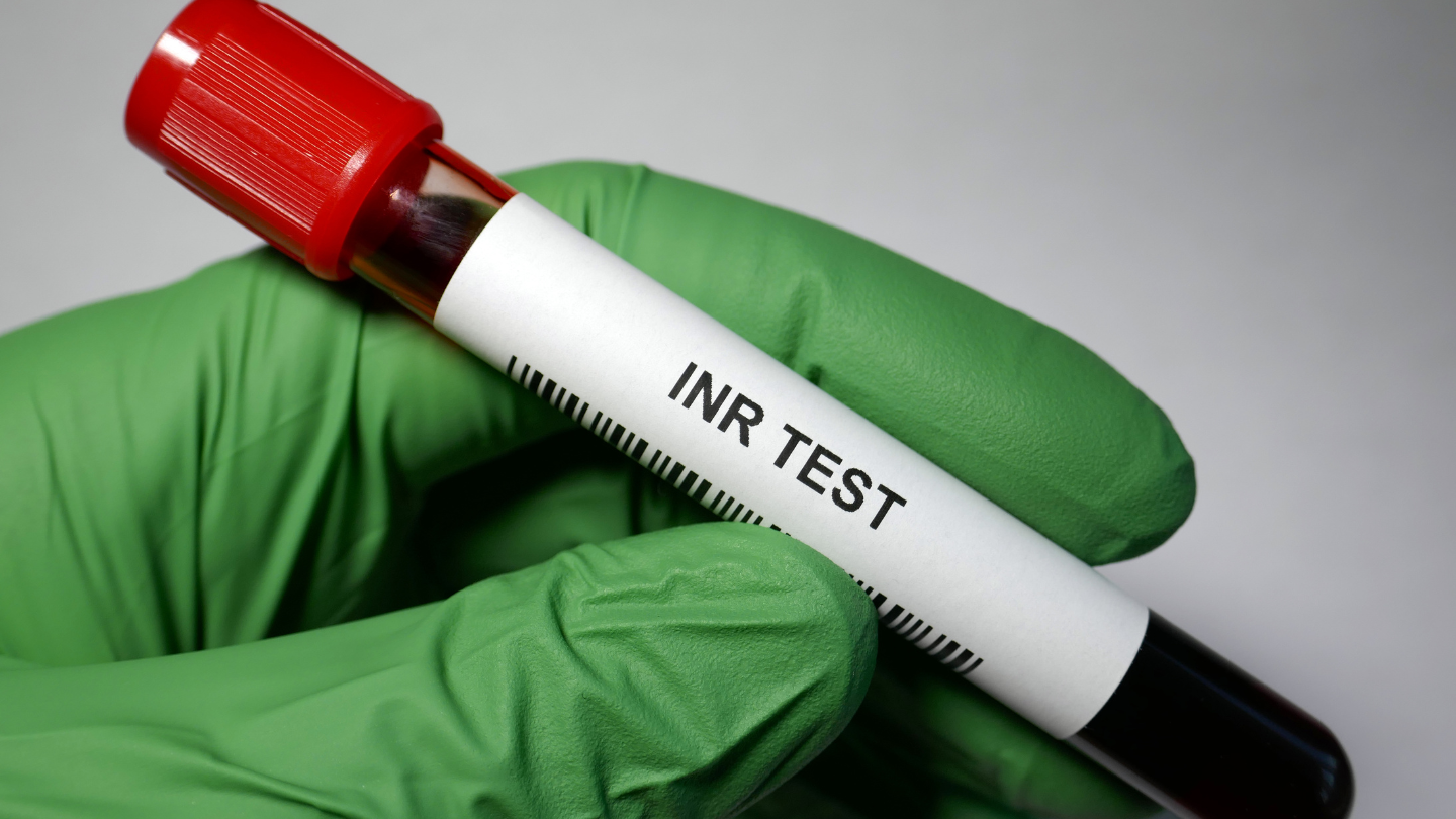 Nhiều người thắc mắc xét nghiệm INR là xét nghiệm gì