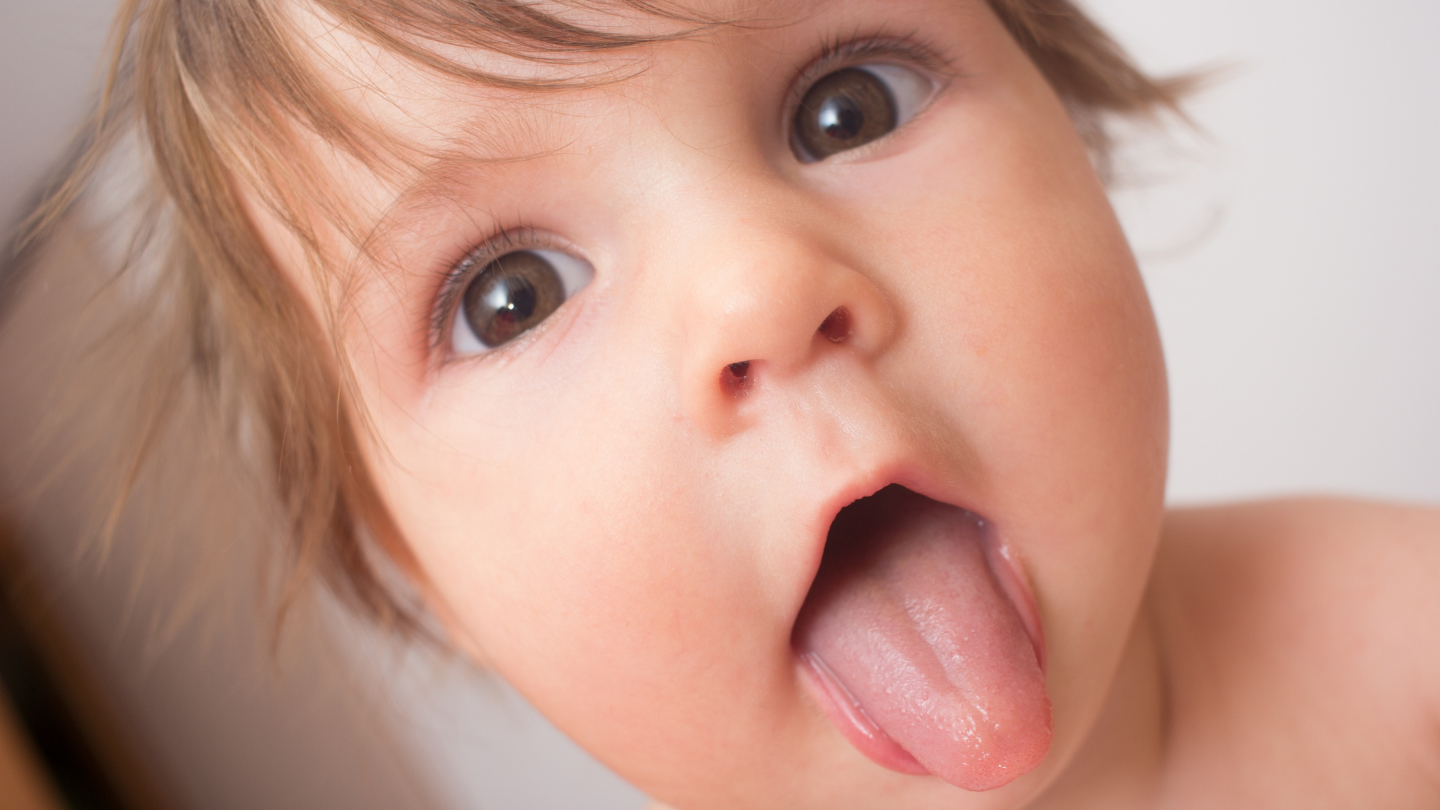 Hình ảnh trẻ không bị dính thắng lưỡi và dấu hiệu trẻ bị dính thắng lưỡi  1