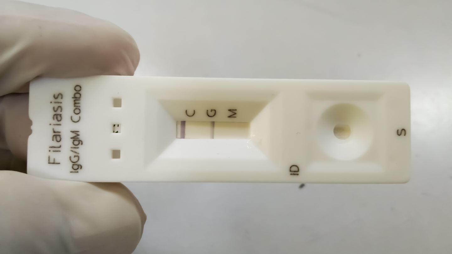 Rubella IgG dương tính có nghĩa rằng trong máu đang tồn tại kháng thể chống lại virus Rubella
