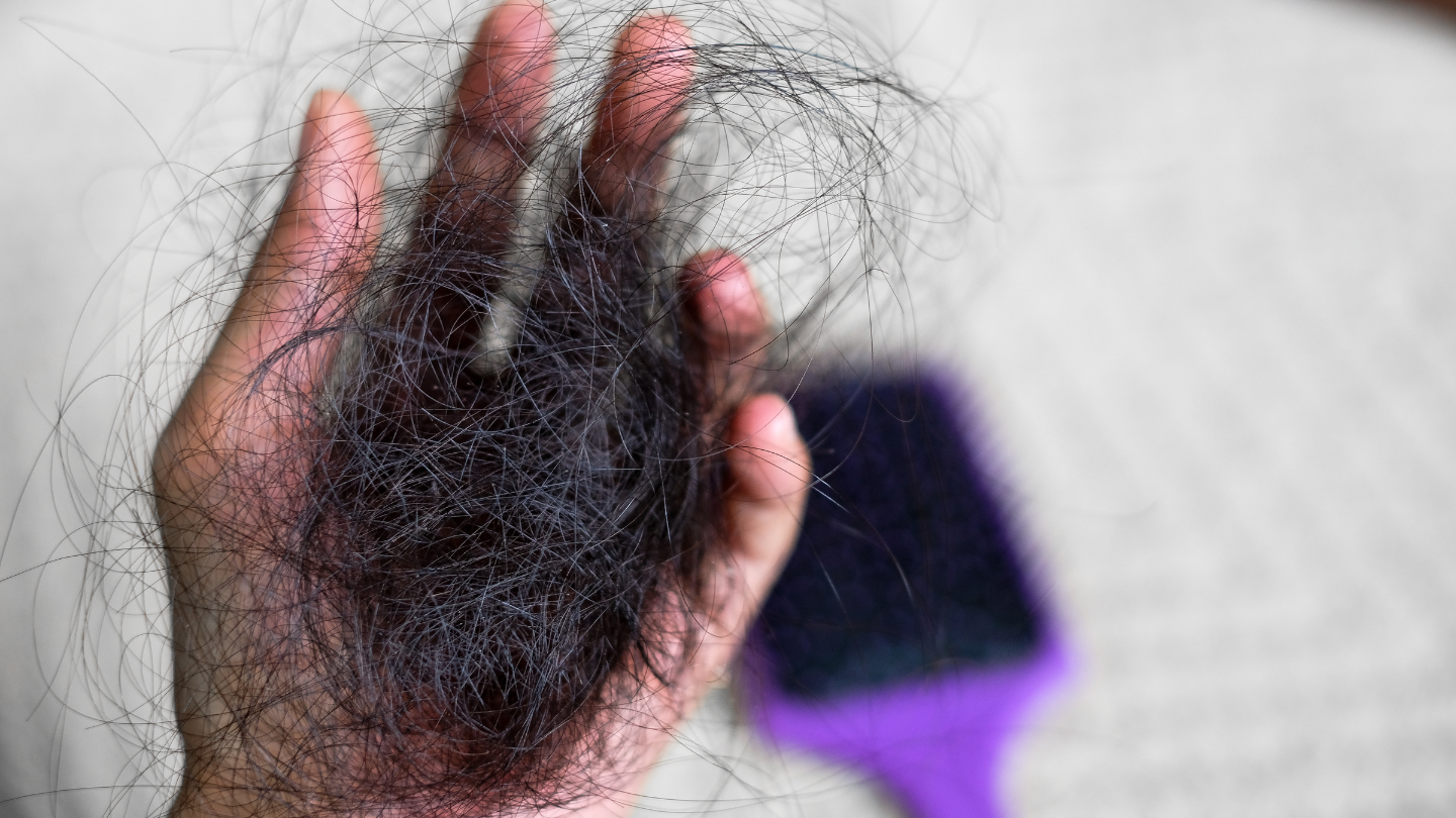 Rụng tóc nhiều ở tuổi dậy thì có đáng lo không?