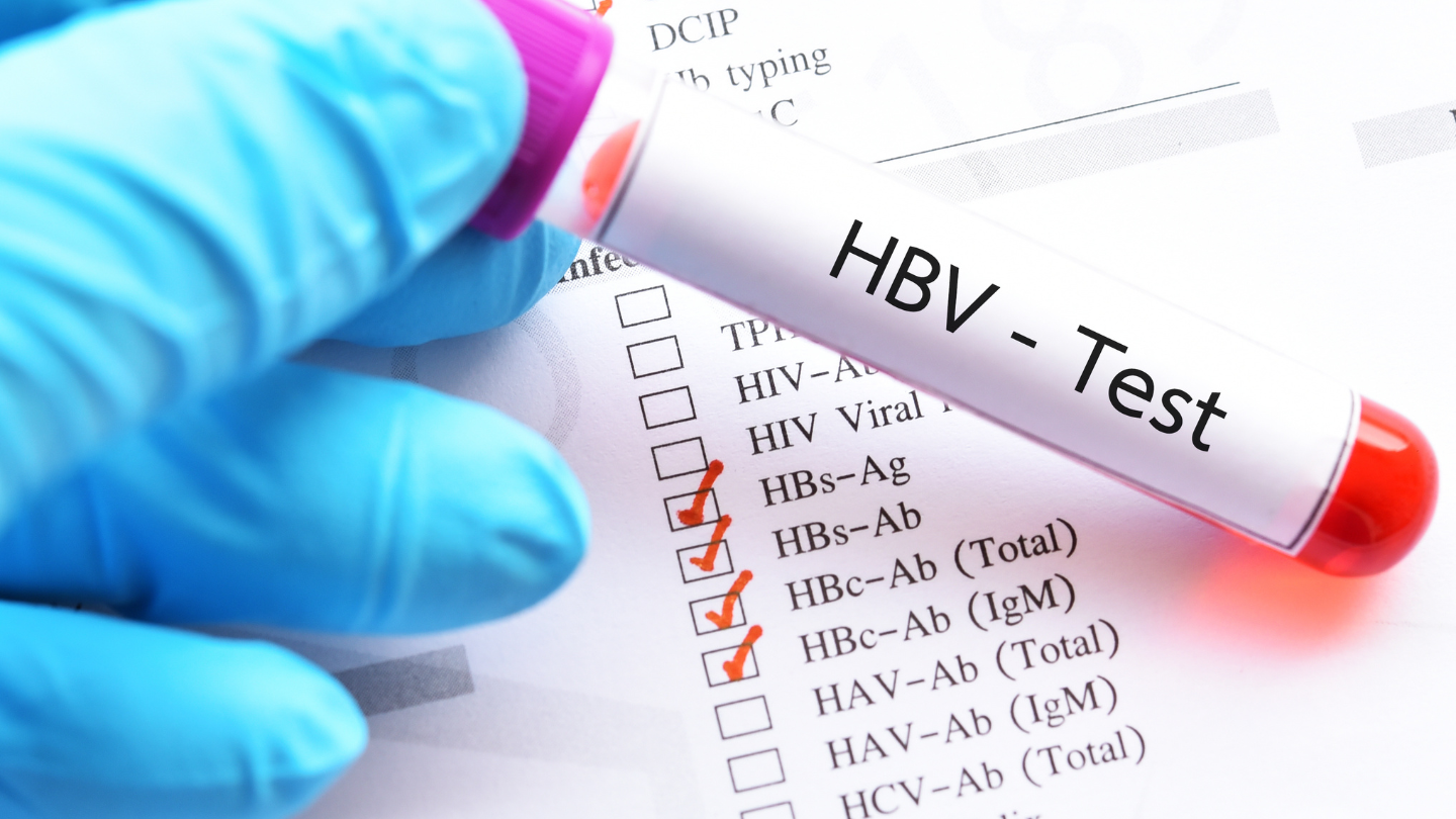 Xét nghiệm HBV là gì là câu hỏi được nhiều người quan tâm
