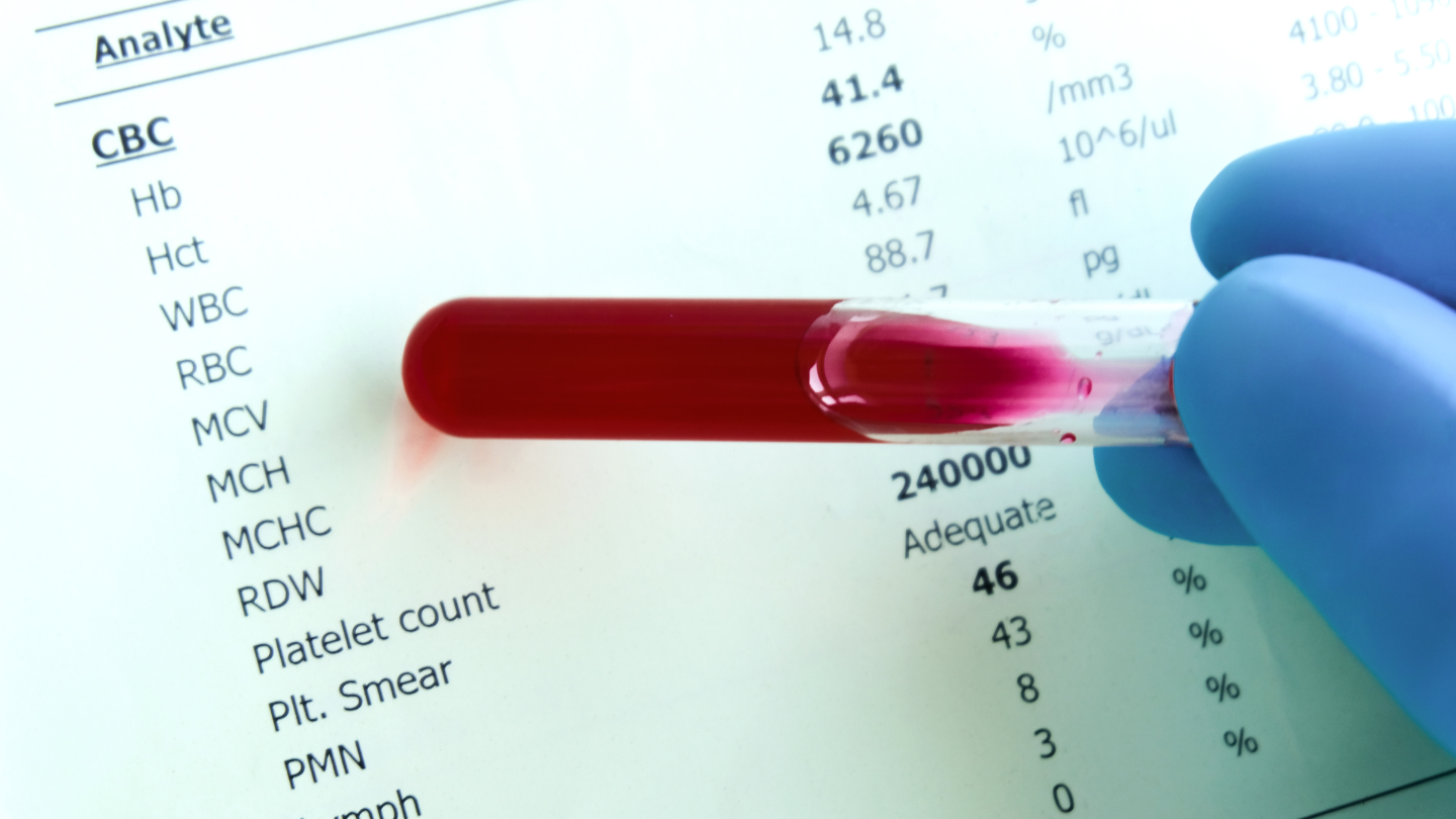 Xét nghiệm máu ở đâu TPHCM là thắc mắc của nhiều người