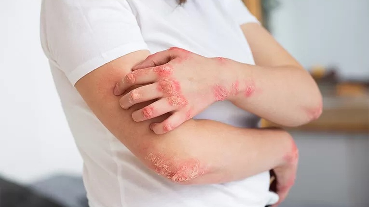 20 bệnh nền khiến người mắc COVID-19 có nguy cơ gia tăng mức độ nặng và tử vong cao 1