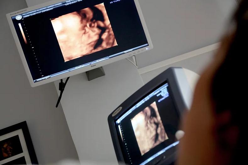27 tuần là mấy tháng? Gợi ý cách chăm sóc mẹ bầu 27 tuần 2
