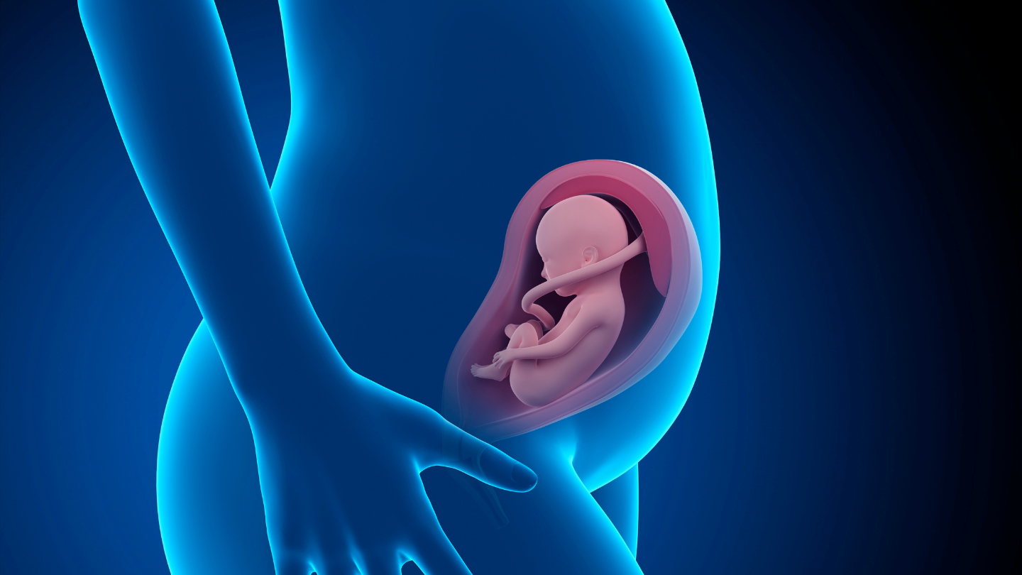 Nang giáp móng hình thành ngay từ trong bụng mẹ do bất thường trong quá trình phát triển phôi thai