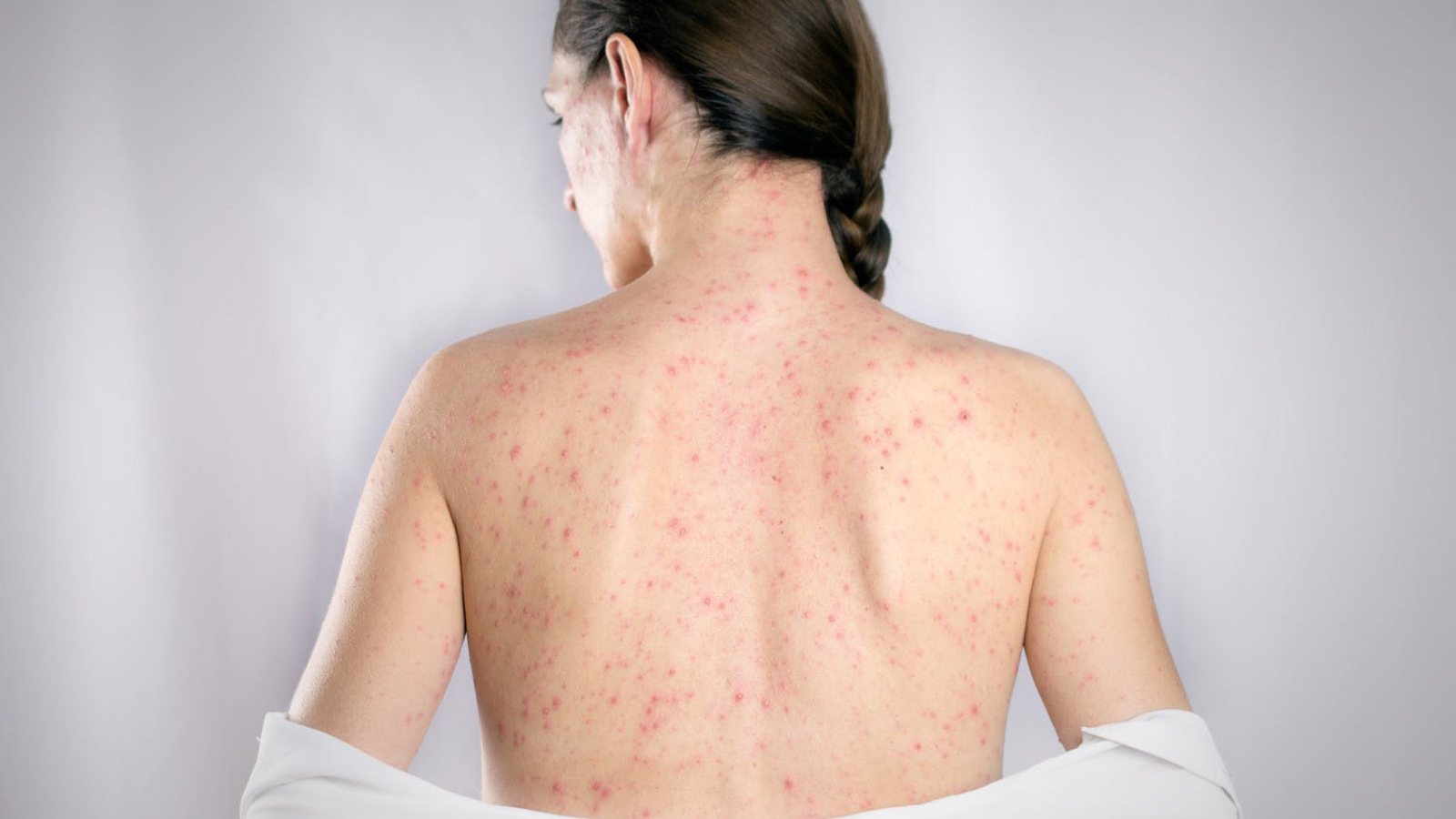 benh-rubella-o-phu-nu-mang-thai 2.png