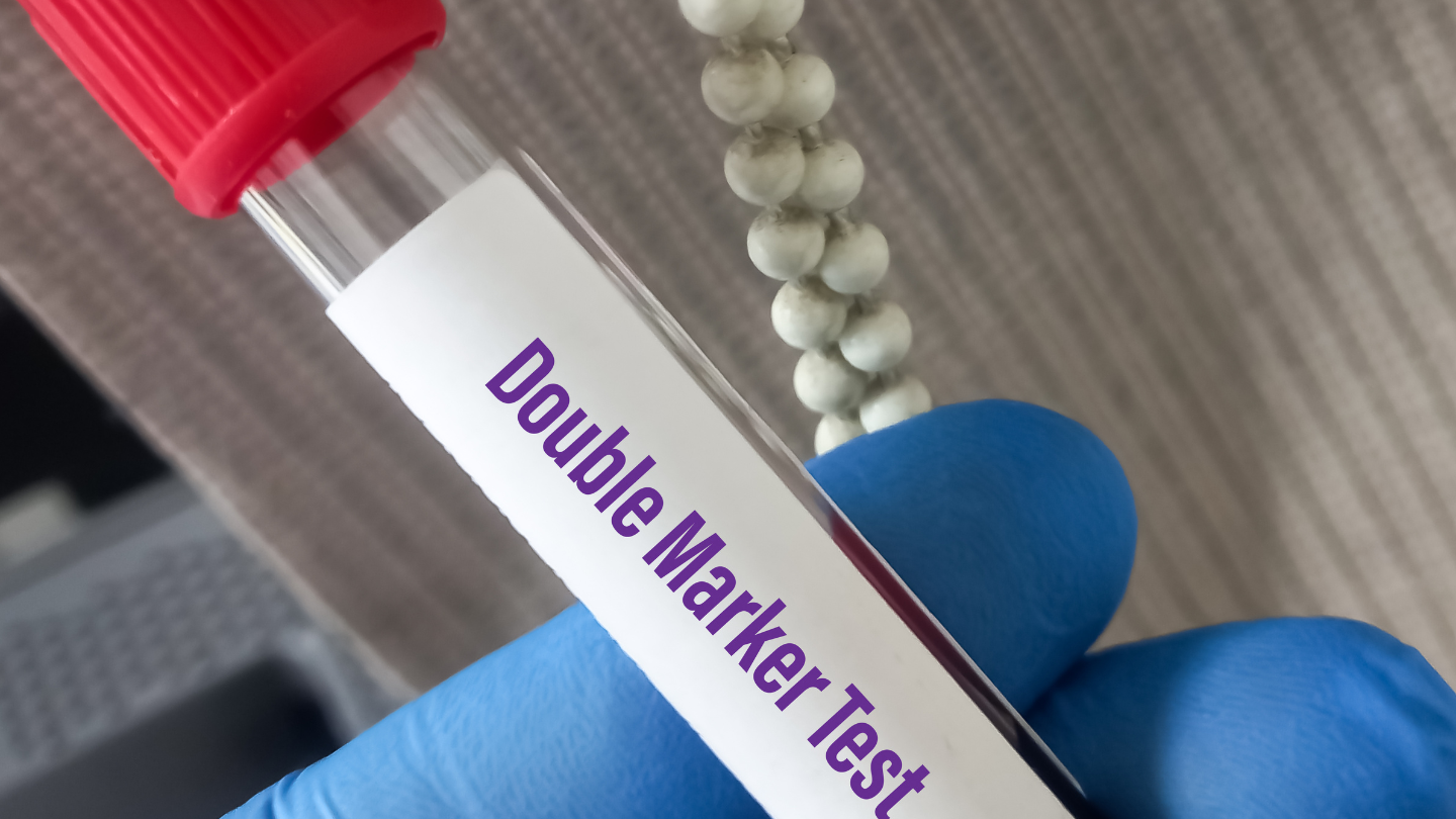 Double Test có chi phí vừa phải, dùng phổ biến ở các bệnh viện