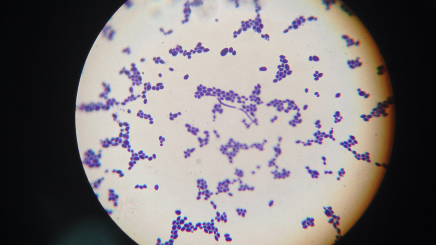 Candida albicans là loại nấm men thường gặp nhất gây viêm âm đạo do nấm ở phụ nữ