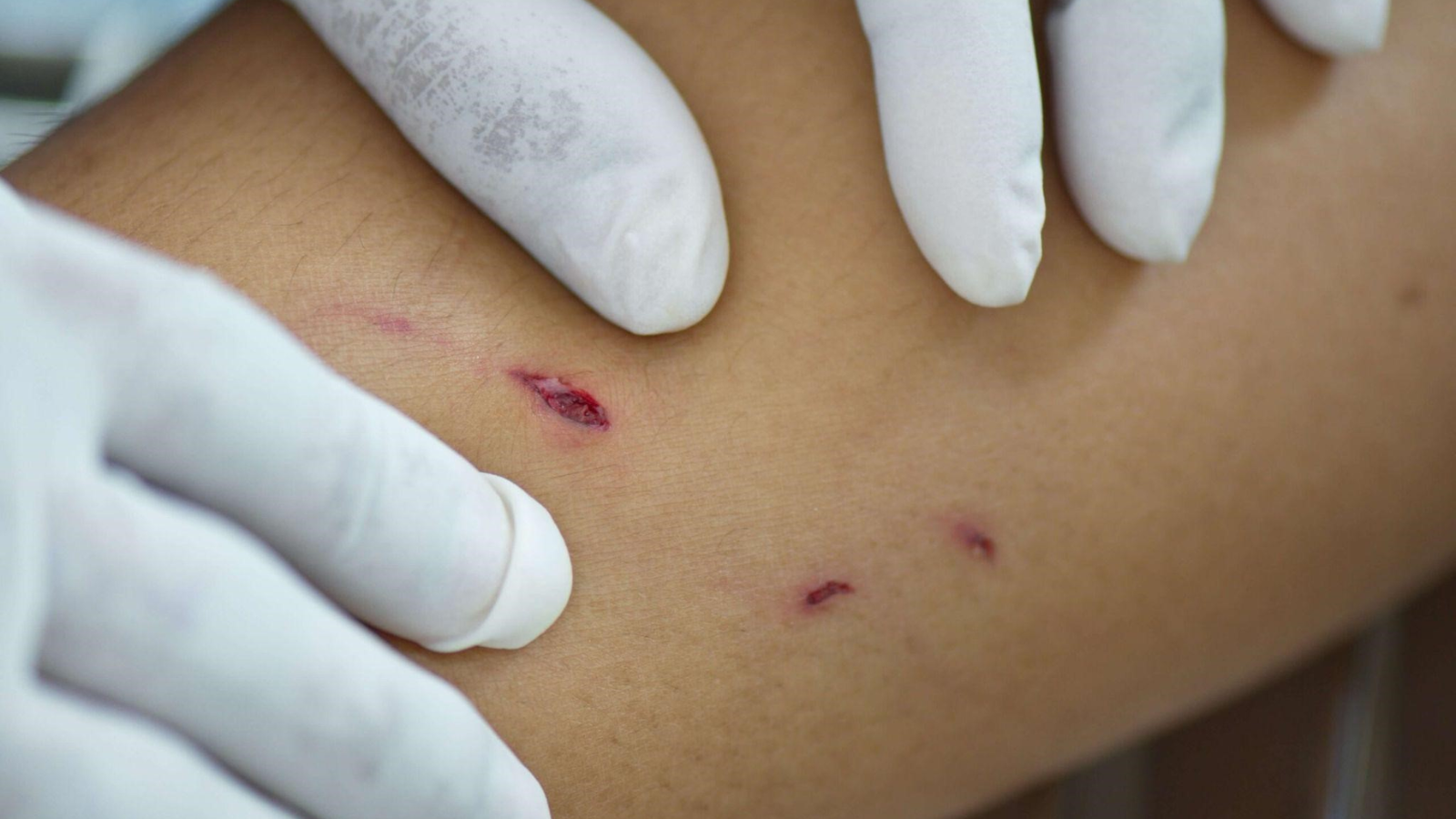 sau-khi-bi-cho-can-bao-lau-thi-chich-ngua-nhung-dieu-quan-trong-can-biet-ve-vac-xin-dai-de-bao-ve-suc-khoe 2.png