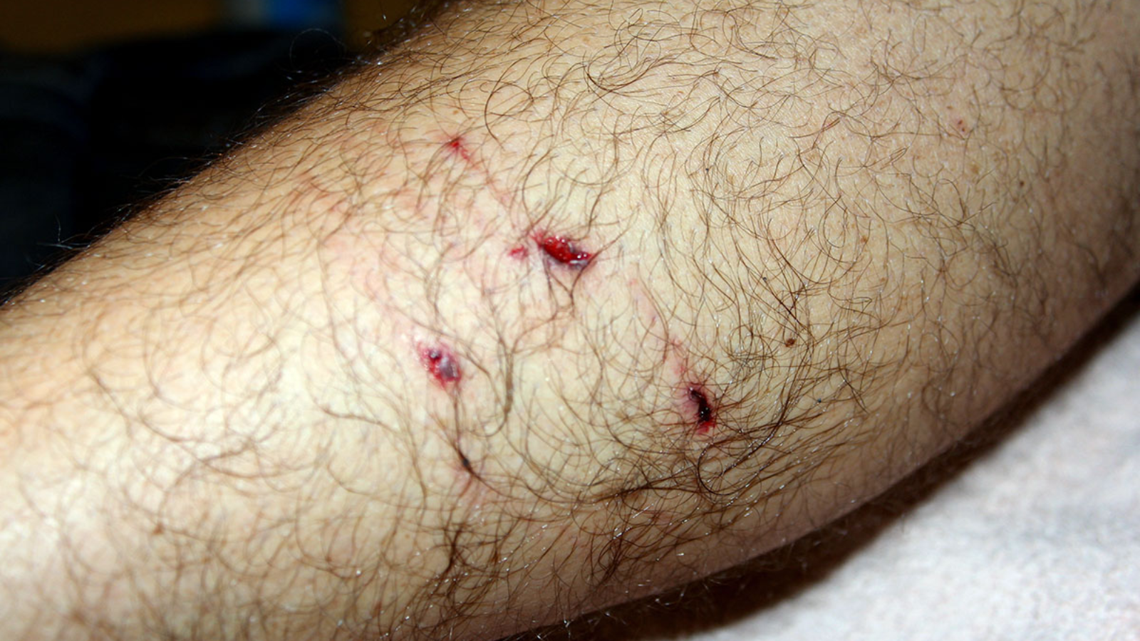 cho-tiem-phong-dai-can-nguoi-co-sao-khong-nhung-dieu-quan-trong-can-biet-de-bao-ve-suc-khoe 2.png