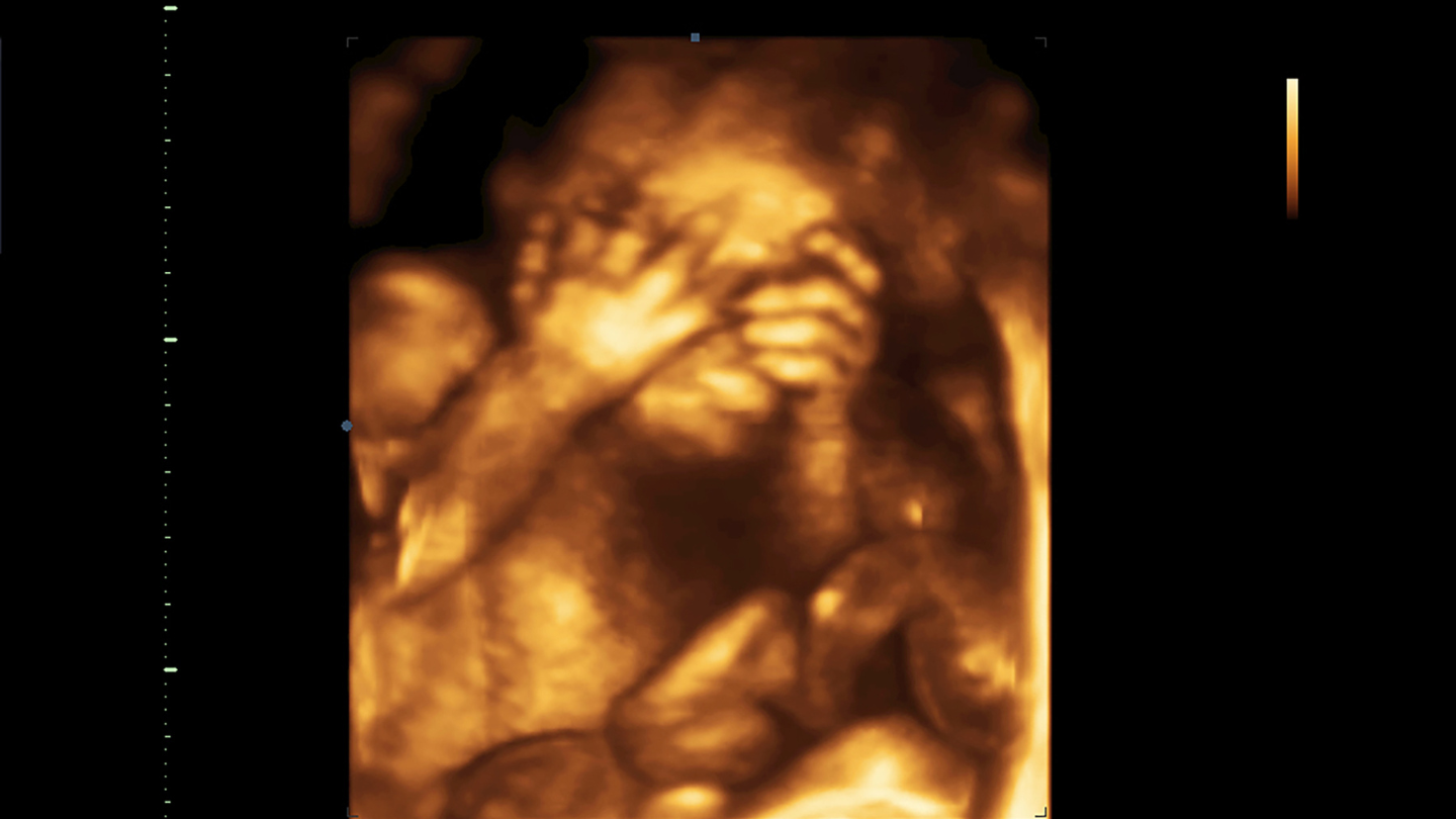 Thai nhi ở tháng thứ 6 đã phát triển đầy đủ cơ quan