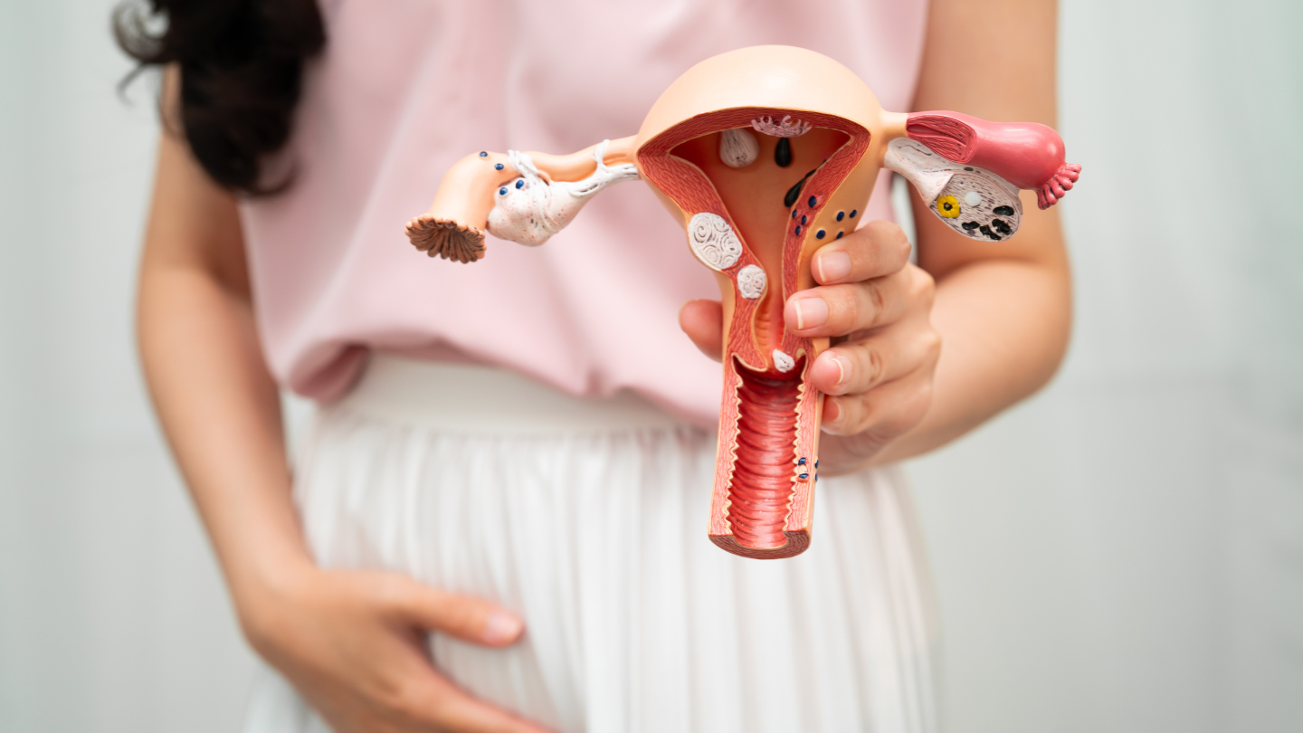 Viêm nhiễm phụ khoa kéo dài nếu không được điều trị triệt để có thể gây tắc nghẽn vòi trứng
