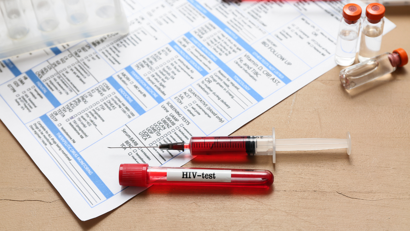 HIV test nhanh kháng thể (AB test) có độ chính xác cao khi được thực hiện đúng quy trình và tại cơ sở y tế uy tín
