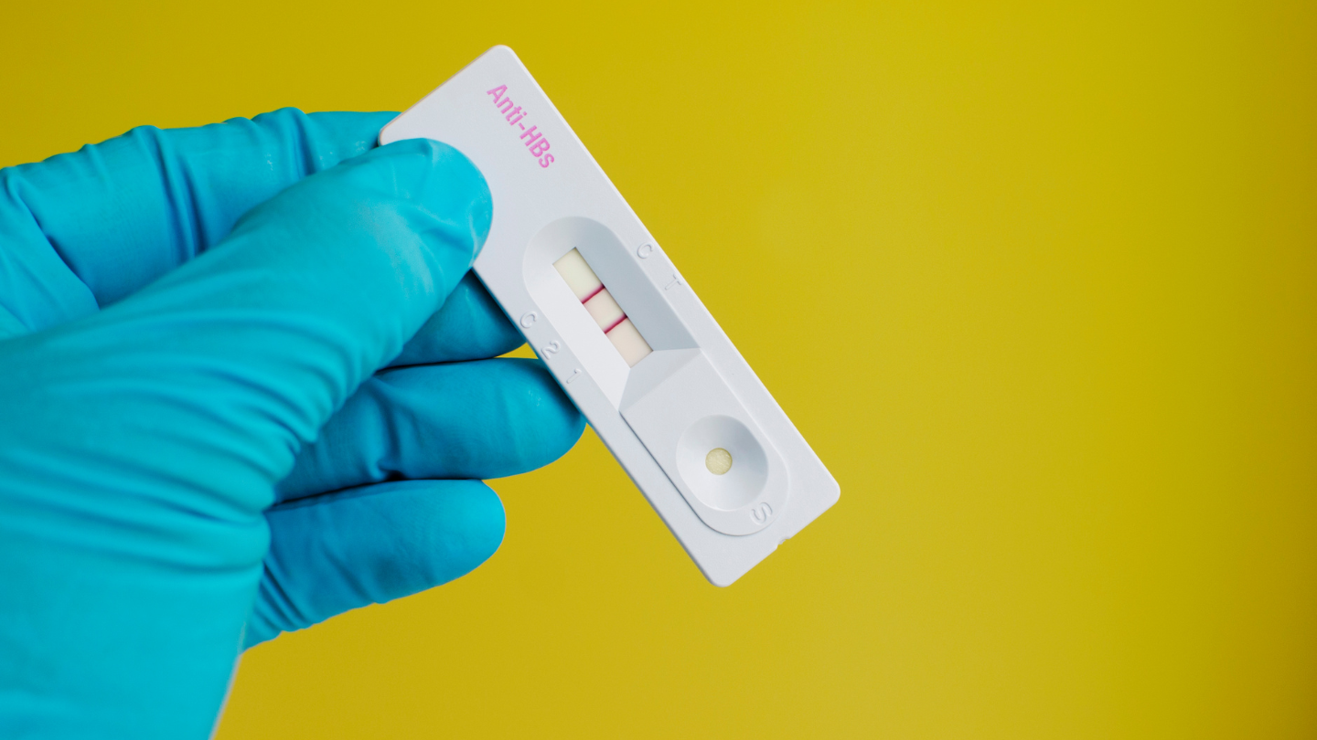 Xét nghiệm Anti-HBs có thể được bác sĩ chỉ định thêm để đánh giá kết quả một cách toàn diện