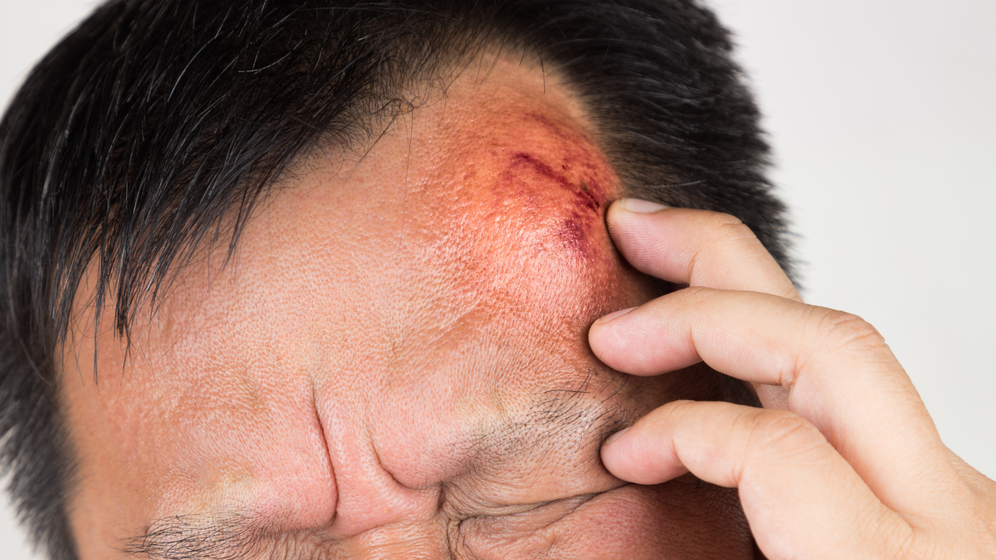 Vết thương đã lành nhưng bất thường sẽ cần được thăm khám