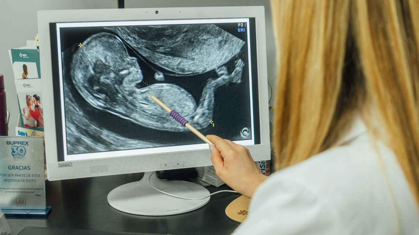 Theo dõi tốc độ tăng trưởng qua nhiều lần siêu âm giúp bác sĩ đánh giá chính xác thai nhi có phát triểnTheo dõi tốc độ tăng trưởng qua nhiều lần siêu âm giúp bác sĩ đánh giá chính xác thai nhi có phát triển