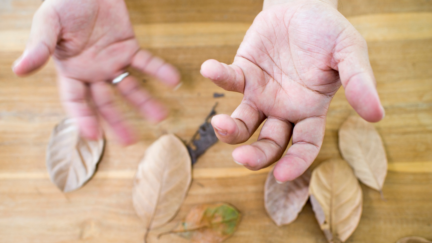 Ở giai đoạn 2 của Parkinson, các triệu chứng điển hình dần xuất hiện ở 2 bên cơ thể