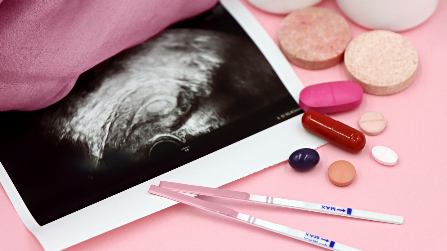 Thai 7 tuần ra máu có thể là dấu hiệu dọa sảy thai, nhưng cũng có thể do nguyên nhân lành tính