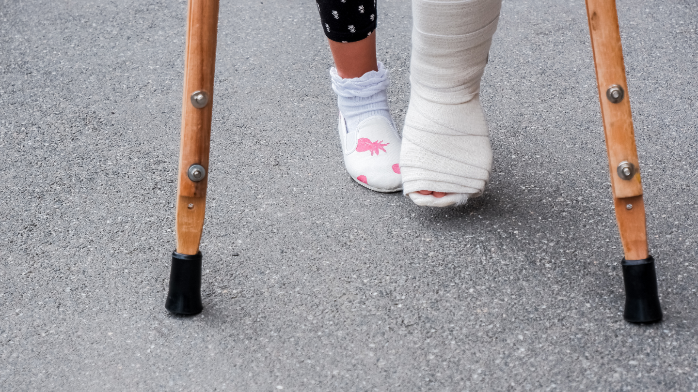 Gãy xương mắt cá chân bao lâu đi được là câu hỏi của nhiều người