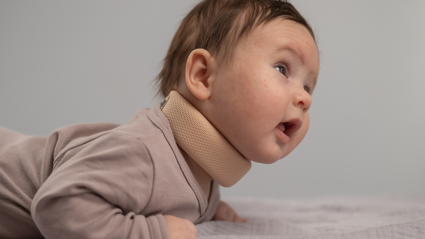 Việc cho trẻ sơ sinh nằm nghiêng lâu hoặc thường xuyên có thể làm tăng nguy cơ tật vẹo cổ