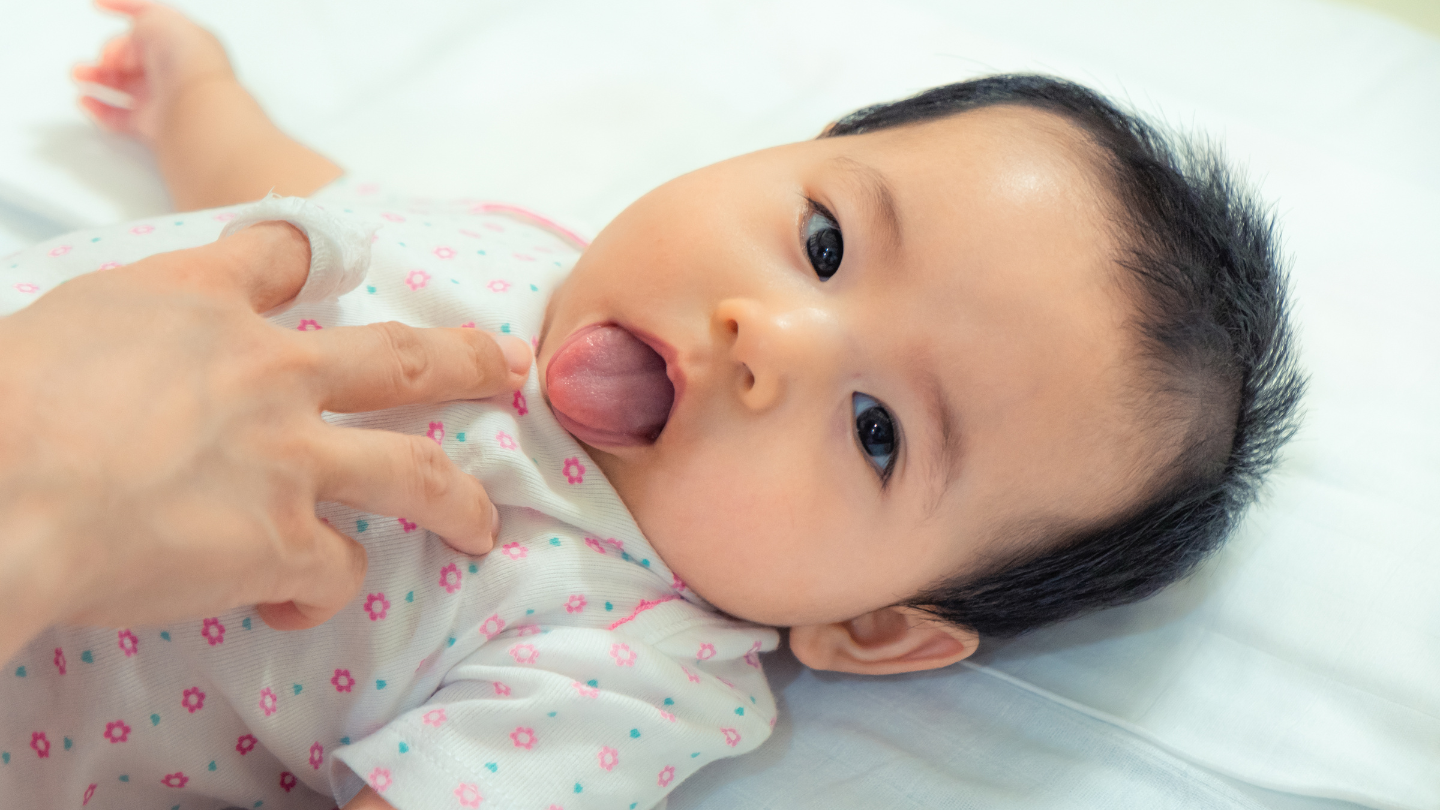 Dính thắng lưỡi độ 1 có cần cắt không? Dấu hiệu nhận biết trẻ bị dính thắng lưỡi 4