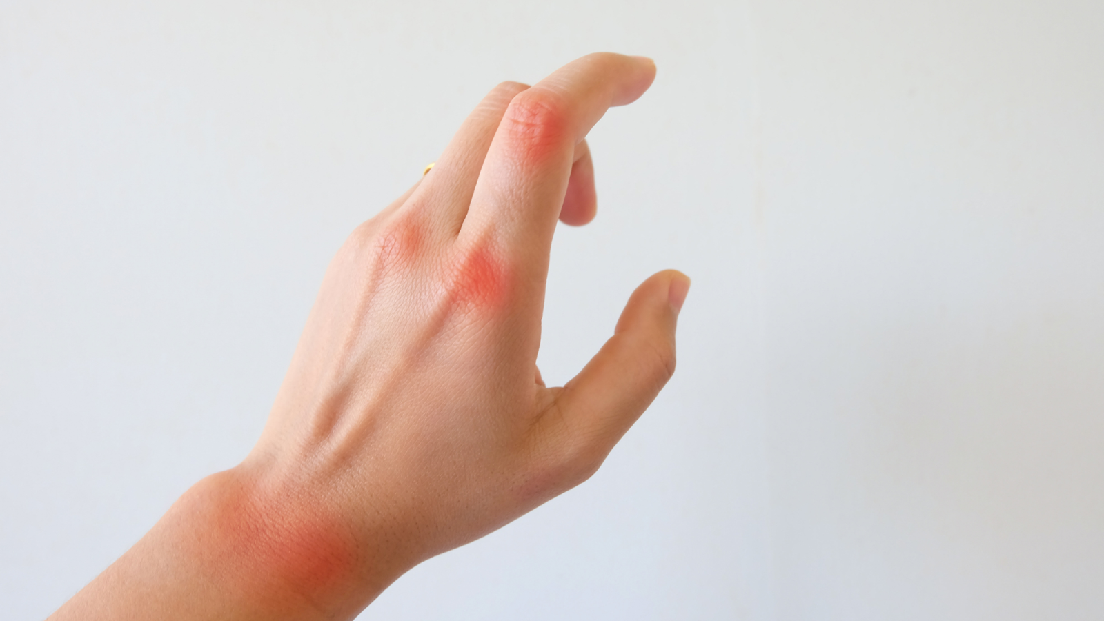 xuat-huyet-giam-tieu-cau 4.png