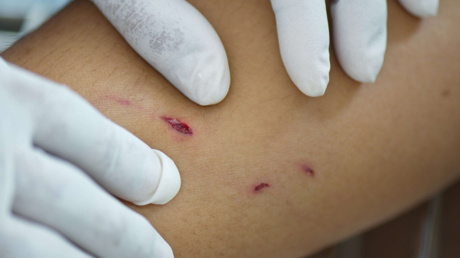 cho-can-sau-15-ngay-van-song-co-can-tiem-vac-xin-dai-khong-nhung-dieu-quan-trong-can-biet 4.png