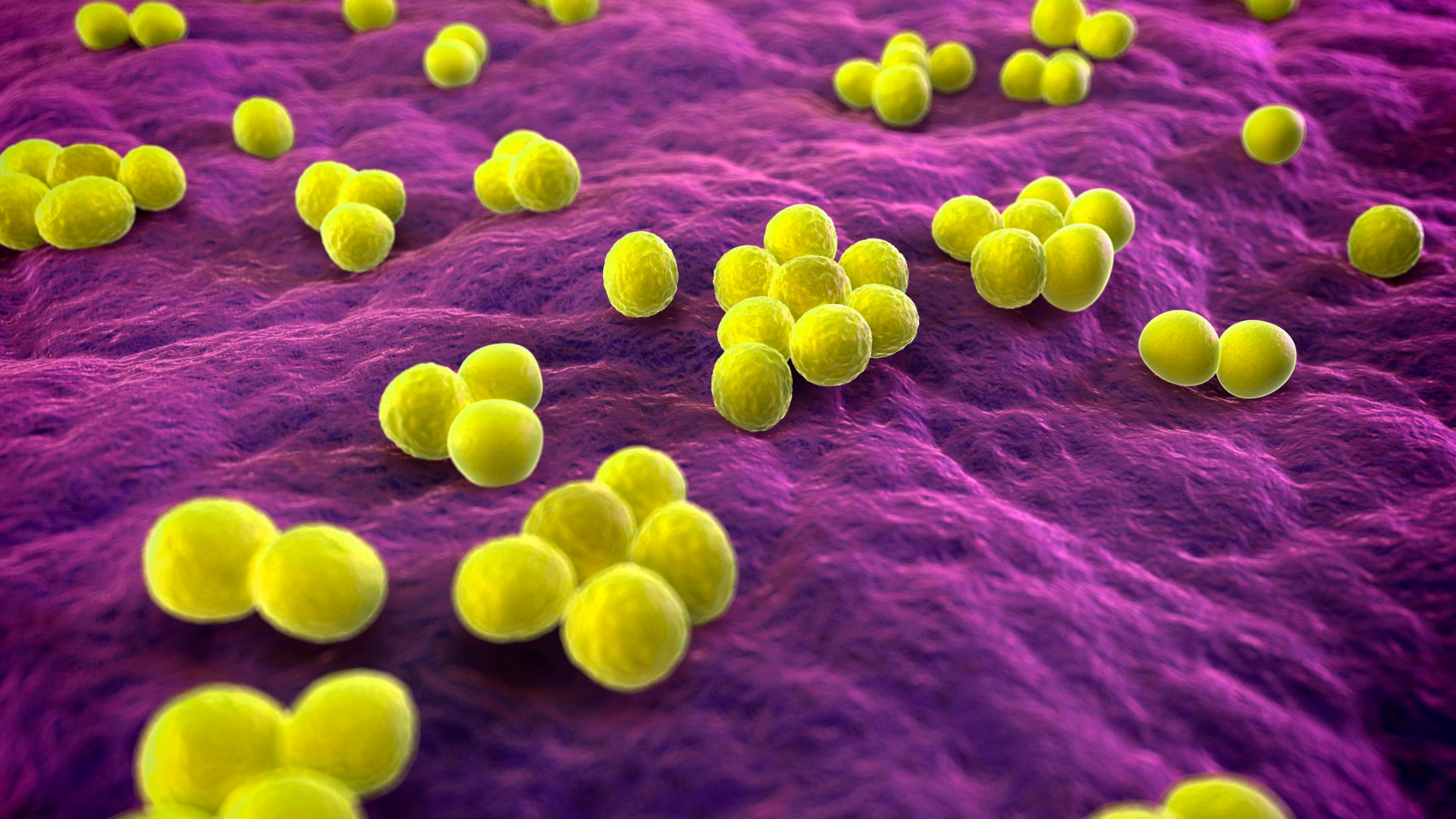 Staphylococcus aureus là nguyên nhân phổ biến nhất