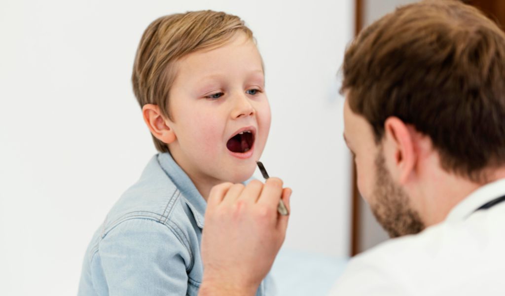 Nhiễm virus, vi khuẩn thường là nguyên nhân phổ biến gây viêm amidan ở trẻ