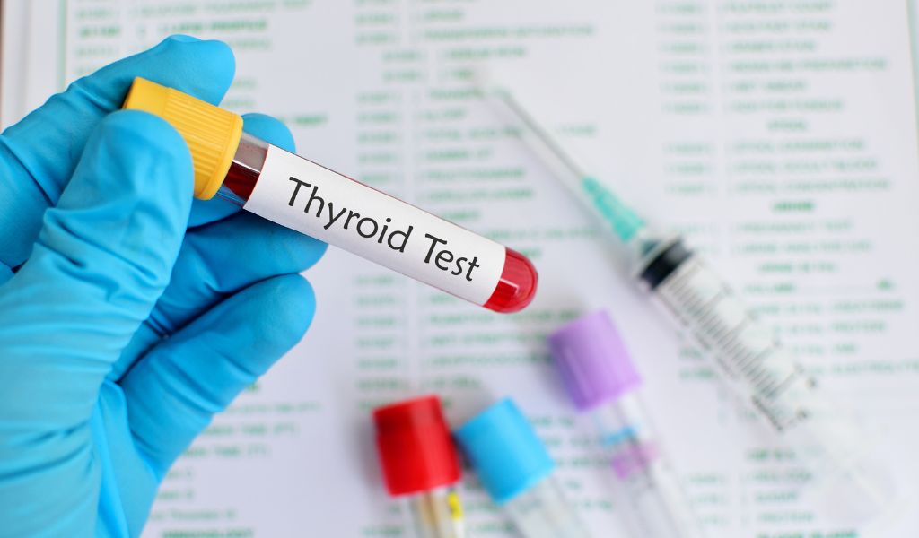 Xét nghiệm suy giáp bẩm sinh bằng cách xét nghiệm các hormone tuyến giáp