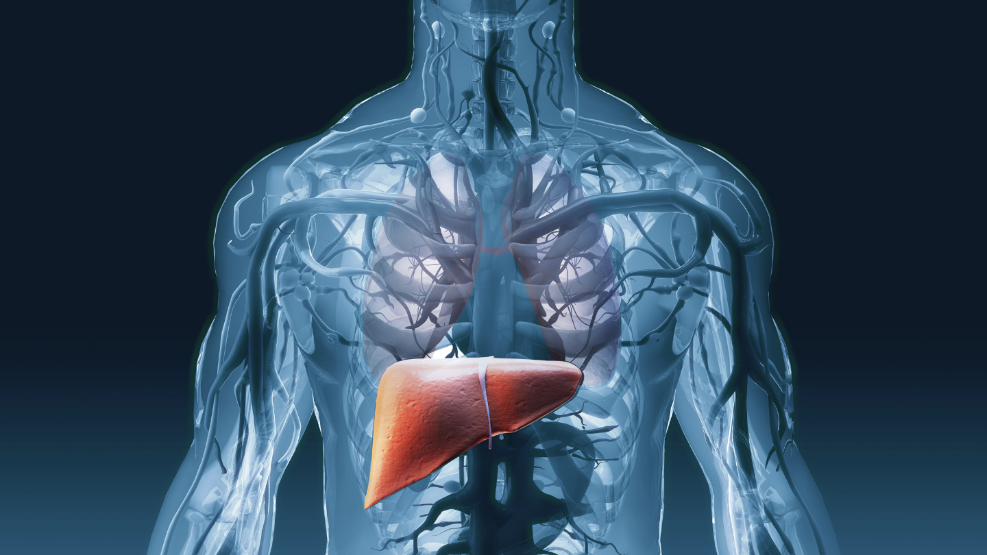 Bệnh gan có thể ảnh hưởng rõ rệt đến kết quả xét nghiệm APTT