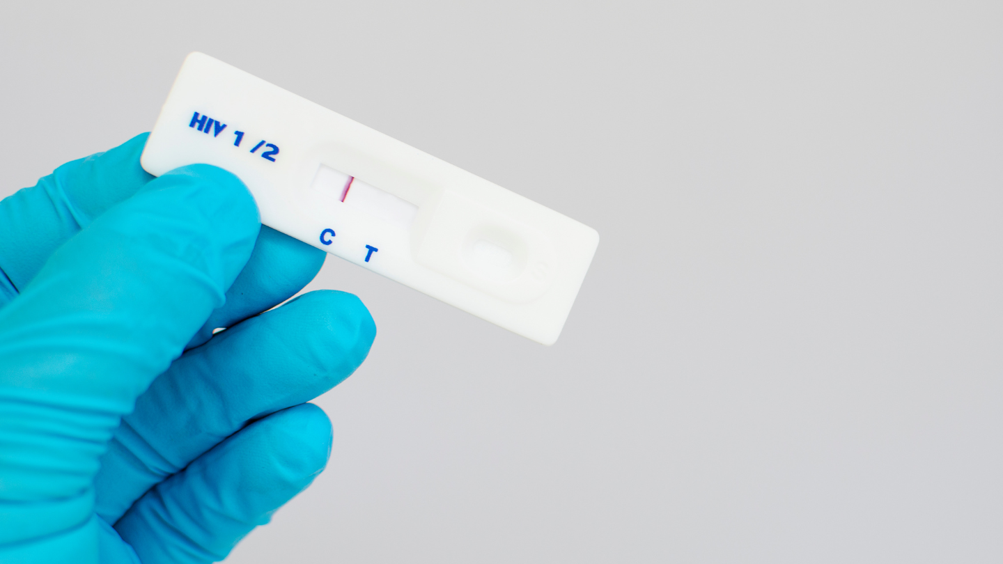 Nếu xét nghiệm HIV quá sớm trong giai đoạn cửa sổ, bạn dễ nhận kết quả âm tính giả