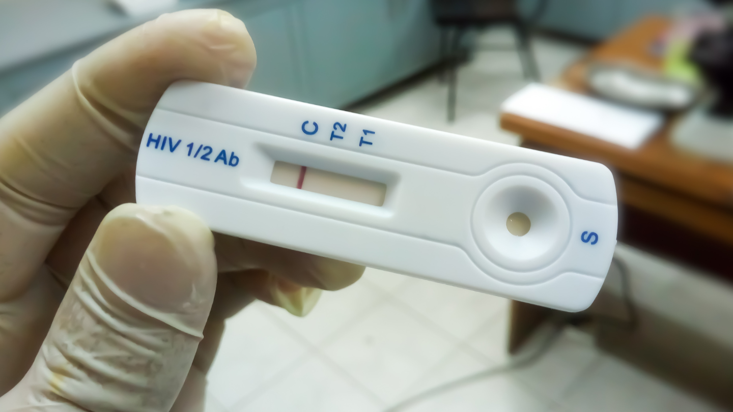 Xét nghiệm nhanh HIV cho kết quả chỉ sau 15 – 30 phút, thuận tiện và dễ thực hiện tại các điểm tư vấn cộng đồng