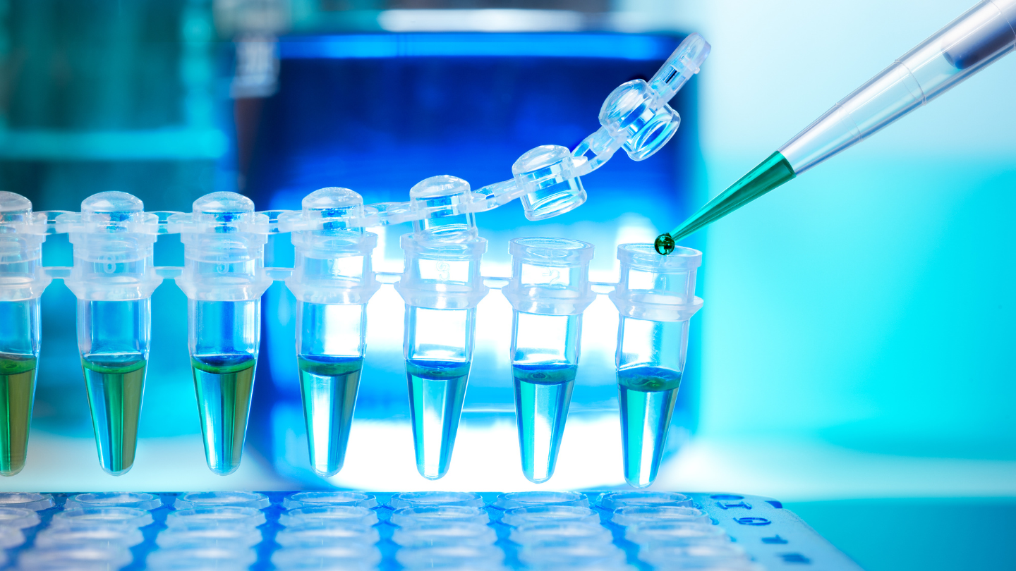 Xét nghiệm PCR giúp phát hiện HIV sớm sau phơi nhiễm, cho kết quả chính xác cao