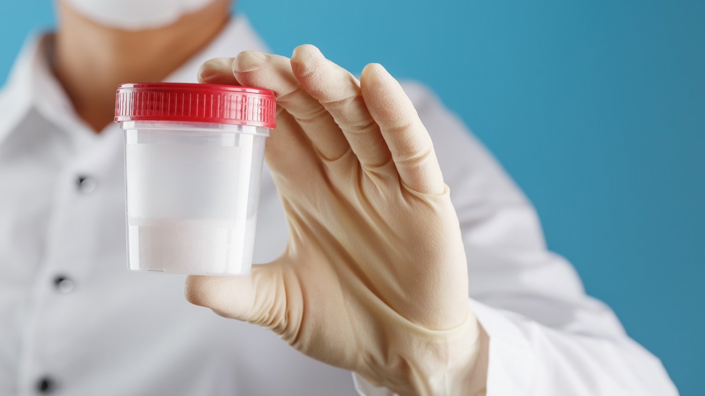 Nam giới có dấu hiệu bất thường về sức khỏe sinh sản nên được tư vấn làm tinh dịch đồ