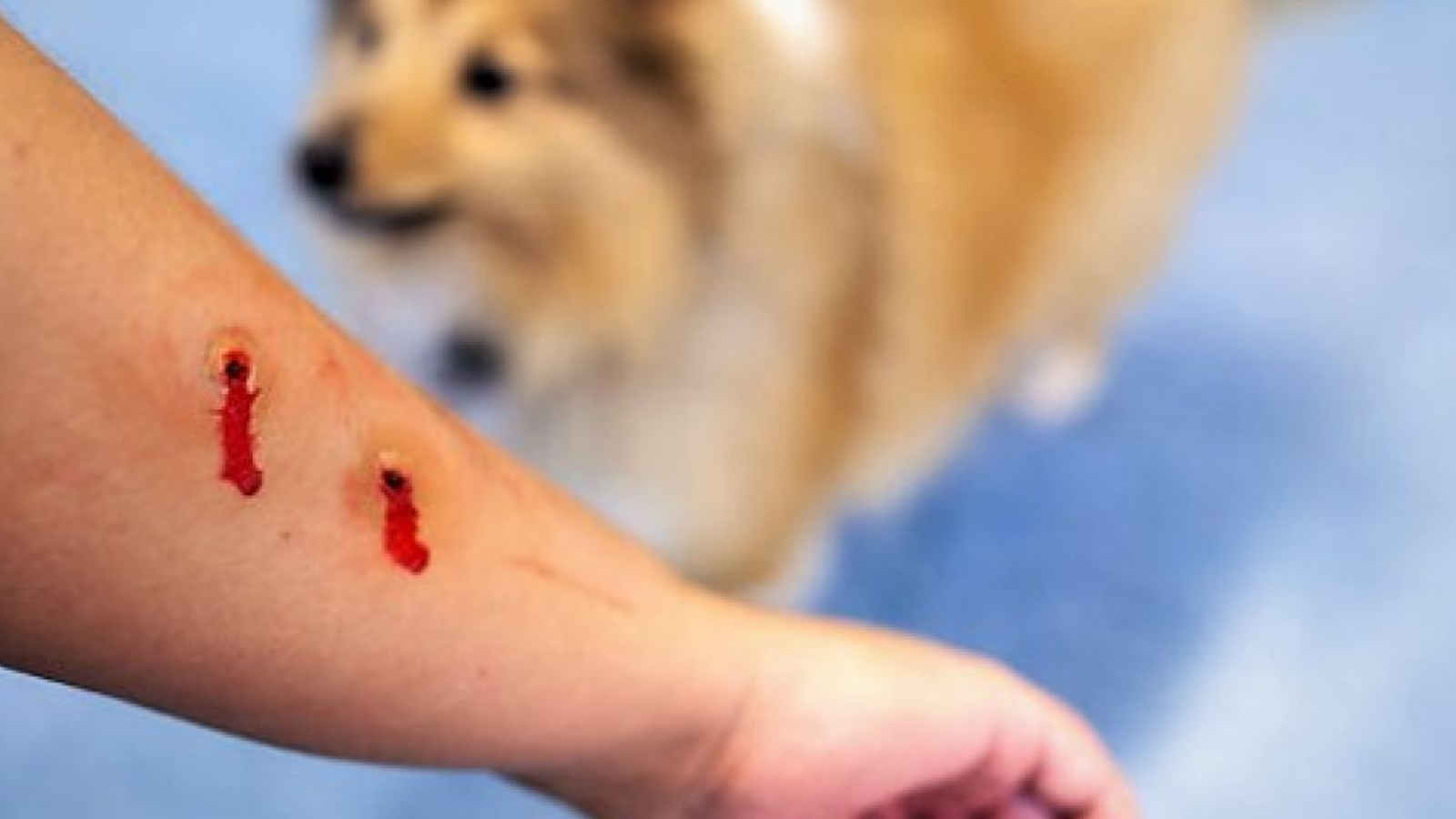 cho-can-sau-bao-lau-thi-an-toan-cach-nhan-biet-va-xu-tri-de-phong-tranh-benh-dai 4.png