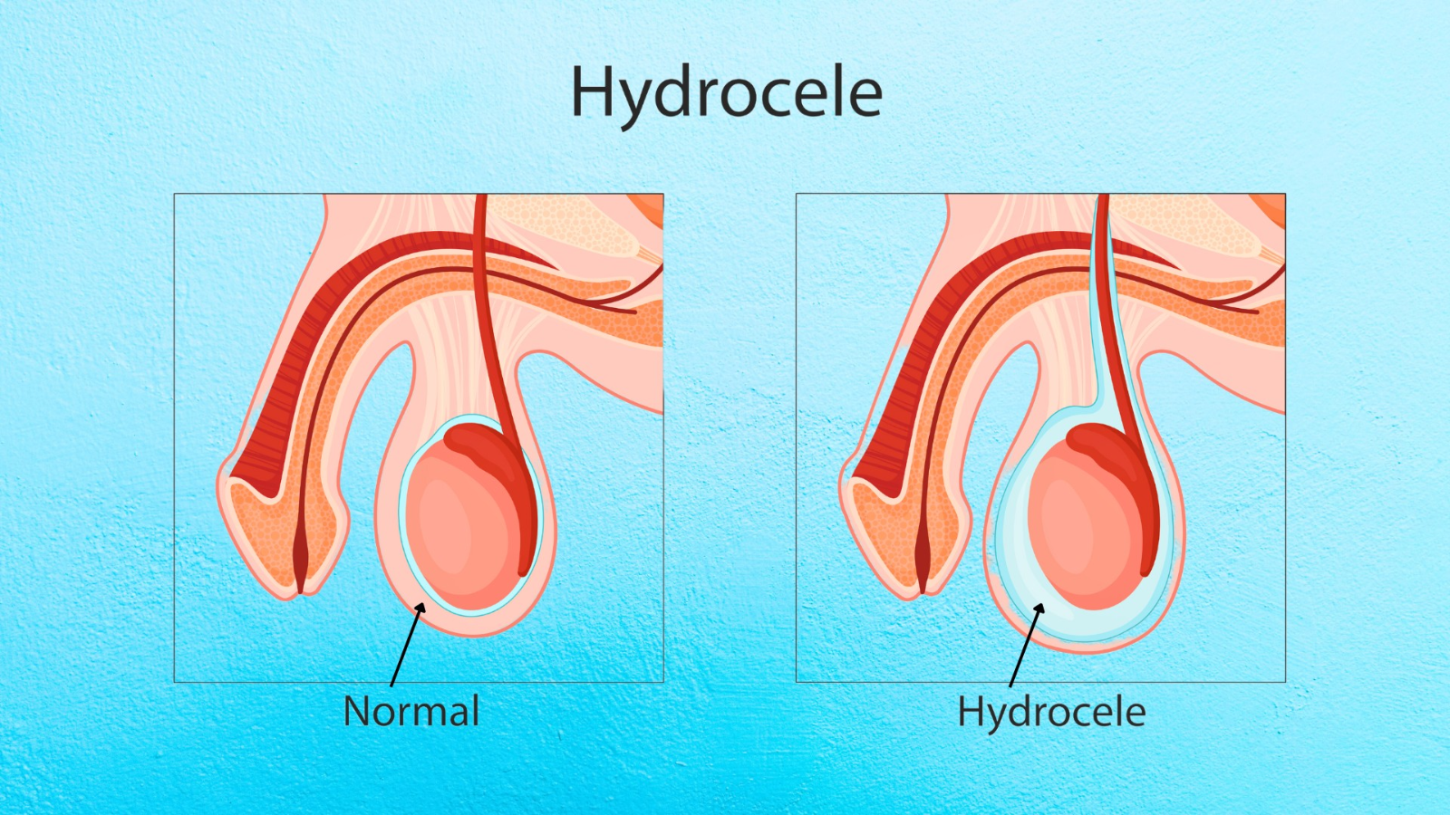 tran-dich-mang-tinh-hoan 5.png