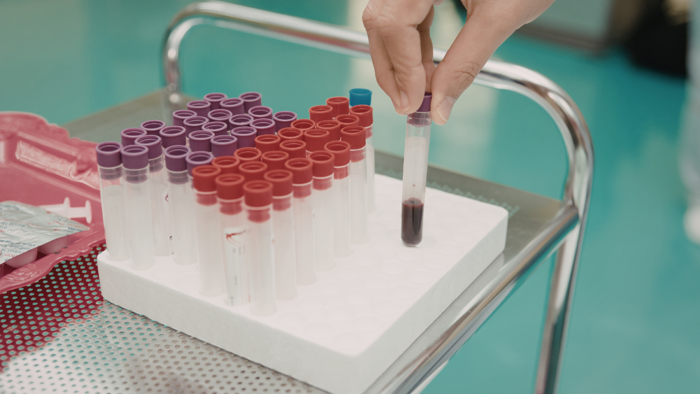 Nếu quá trình lấy, bảo quản hoặc xử lý mẫu không đúng quy định, kết quả có thể bị sai lệch