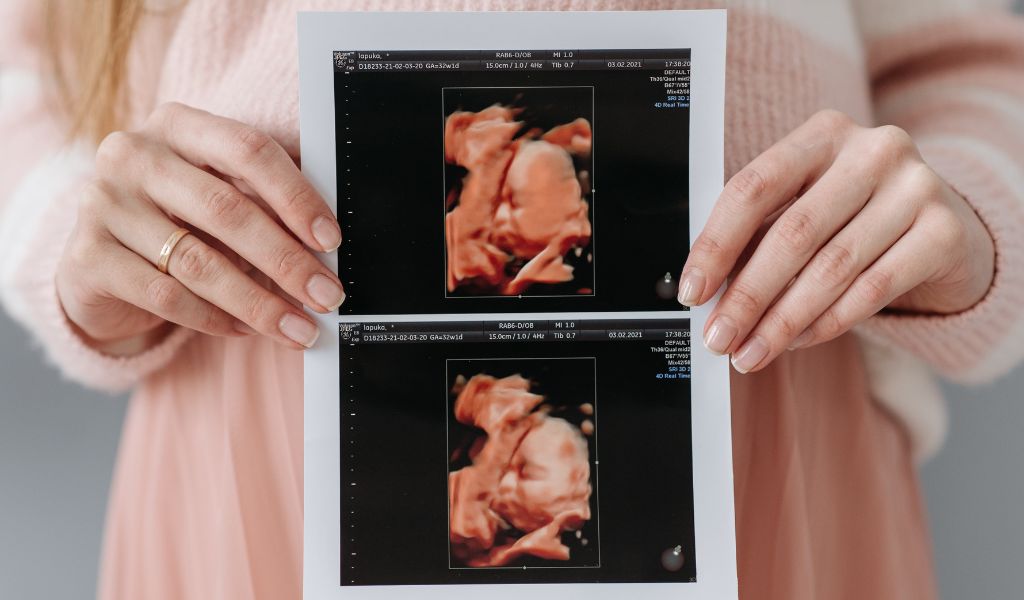 Hạt mít có tác dụng gì? Giá trị dinh dưỡng và lưu ý cho mẹ bầu 2