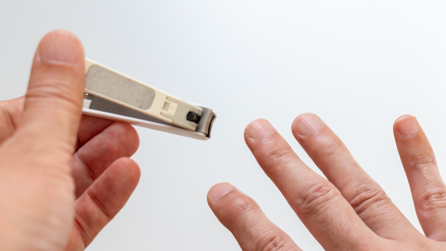 Không nên cắt sát khóe móng tay vì có thể gây gây viêm quanh móng, nhiễm trùng